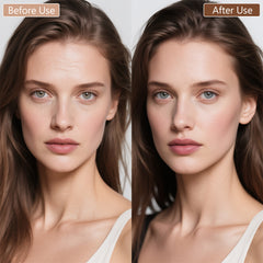 SKINETRY LED Light Therapy Mask