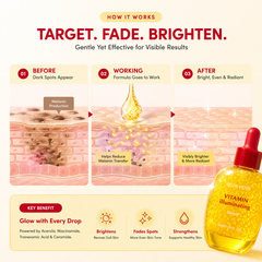 SKINETRY Vitamin Illuminating Serum – Brightening Vitamin C Serum with Niacinamide | Strengthens skin barrier | Hydrates using Ceramide, 1.01oz / 30ml